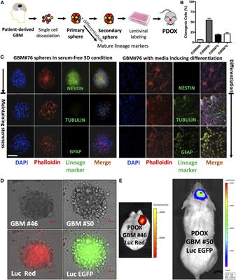 Utility of Glioblastoma Patient-Derived Orthotopic Xenografts in Drug Discovery and Personalized Therapy